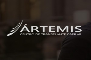 logo Ártemis é uma ótima opção para um implante de cabelo